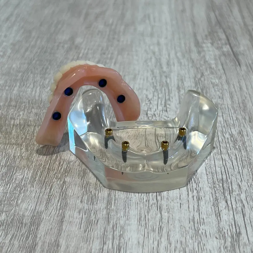 snap-in implant dentures Northwest Florida